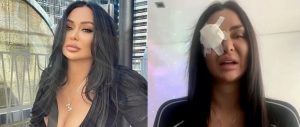 Acid attack on Tik Tok star Jenny Elhassan in Sydney’s CBD
